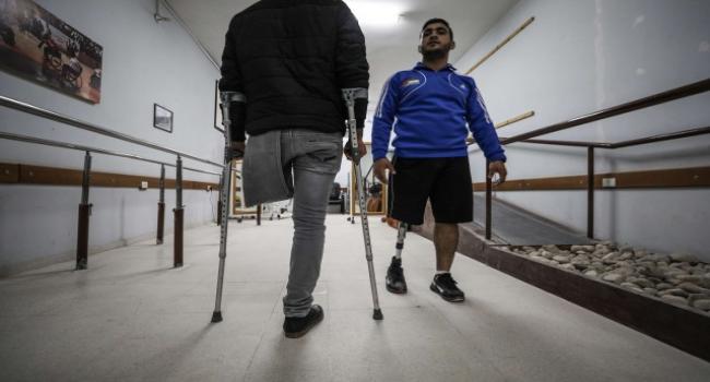 نقص التمويل الصحي قد يؤدي إلى 1700 عملية بتر أعضاء في غزة