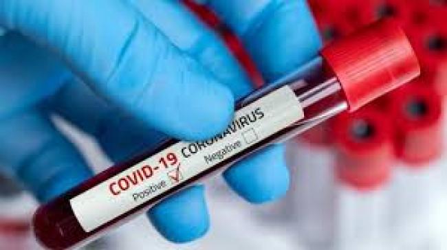 تسجيل 21 حالة وفاة و1529 حالة جديدة حاملة لفيروس كوفيد-19